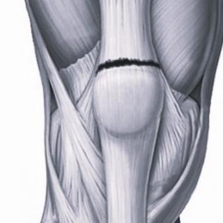 Рентген в диагностике повреждения связок