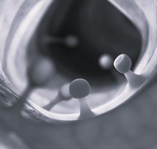 Рентген в диагностике полипа