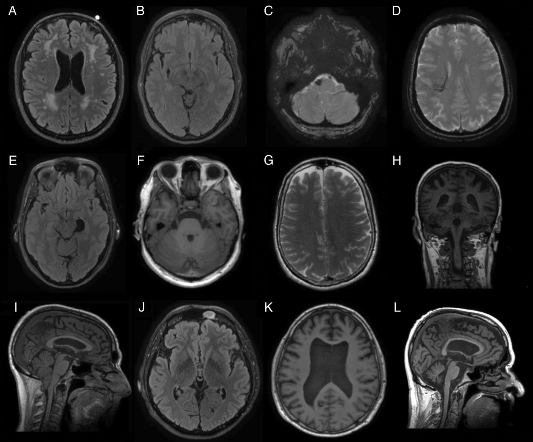 МРТ или КТ сосудов головного мозга, что лучше - ангиография сосудов  недорого в Санкт-Петербурге